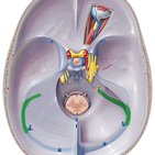 Sigmoid sinus