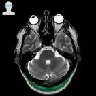 Musculus occipitofrontalis