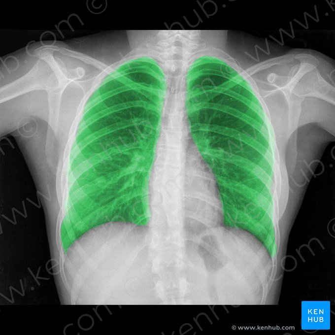 Lung (Pulmo); Image: 