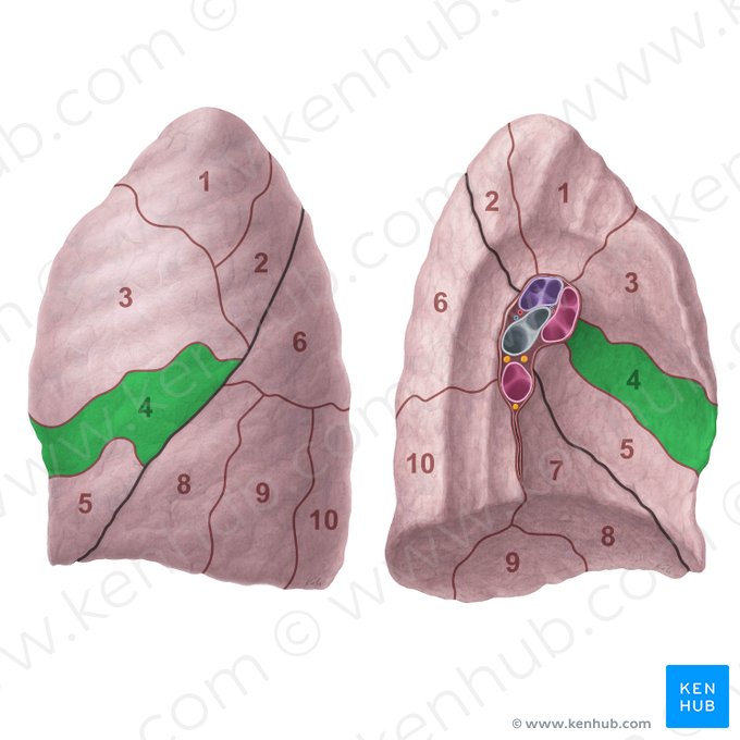Segmentum lingulare superius pulmonis sinistri (Oberes Lingulasegment der linken Lunge); Bild: Paul Kim