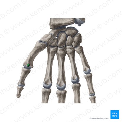 Os sesamoideum radiale articulationis metacarpophalangeae pollicis (Speichenseitiges Sesambein des Daumens); Bild: Yousun Koh