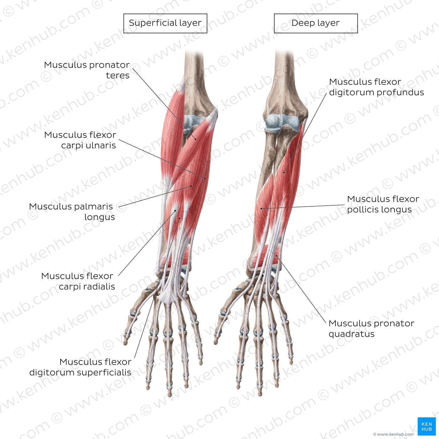 Flexoren des Unterarms