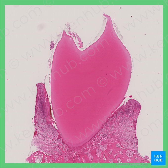Adult tooth; Image: 