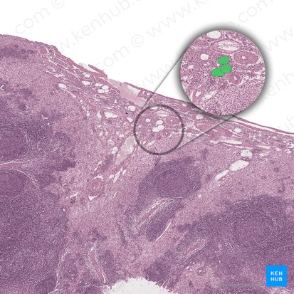 Vaisseau lymphatique afférent (Vas lymphaticum afferens); Image : 