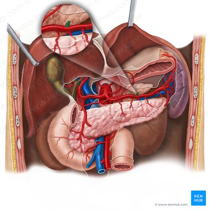 Arteria gastrica posterior (Hintere Magenarterie); Bild: Esther Gollan