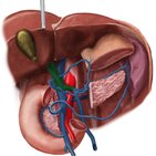 Portosystemic anastomosis