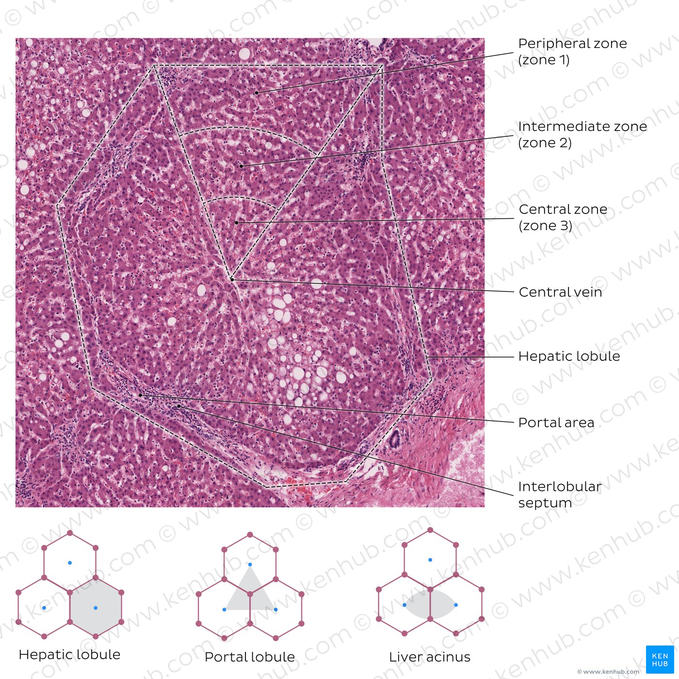 Hepatic lobule. Stain: H&E. High magnification