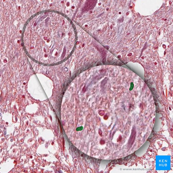 Astrocyte (Astrocytus); Image: 