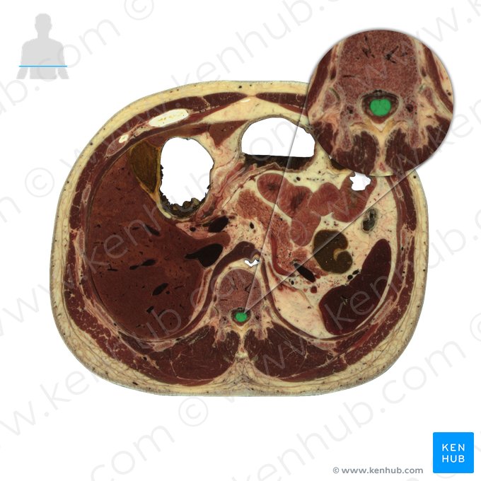 Medula espinal (Medulla spinalis); Imagem: National Library of Medicine