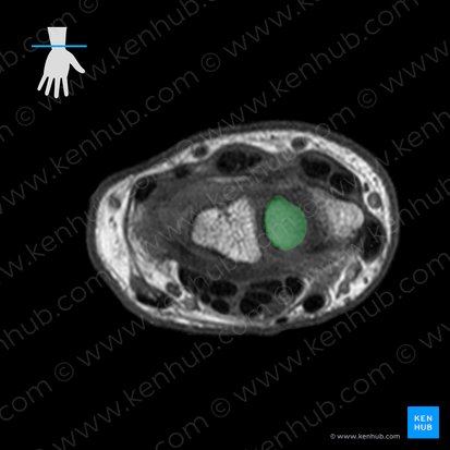 Scaphoid bone (Os scaphoideum); Image: 