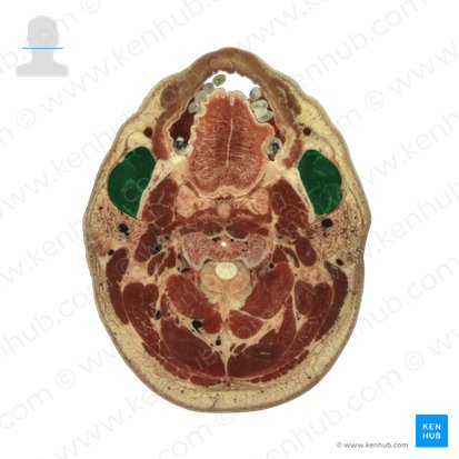 Músculo masetero (Musculus masseter); Imagen: National Library of Medicine