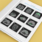 MRI study guide: Test questions and quizzes for review