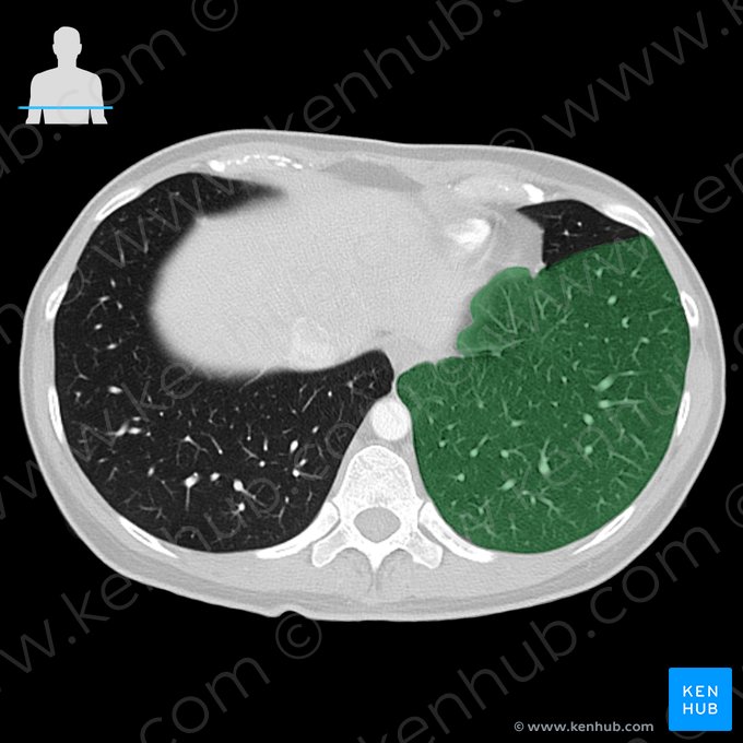 Lobo inferior do pulmão esquerdo (Lobus inferior pulmonis sinistri); Imagem: 