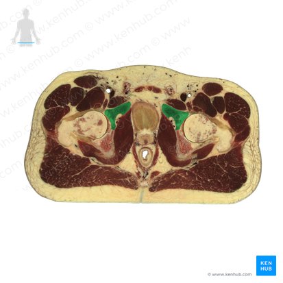 Os pubis (Schambein); Bild: National Library of Medicine