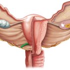 Uterosacral ligament