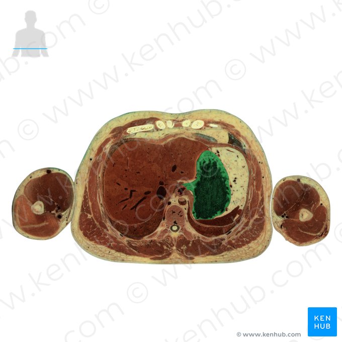 Gaster (Magen); Bild: National Library of Medicine