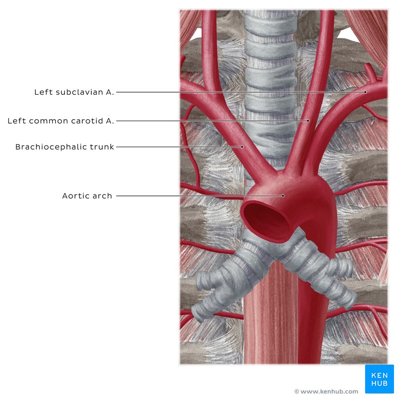 Aortic arch and its branches - anterior view