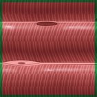 Skeletal muscle