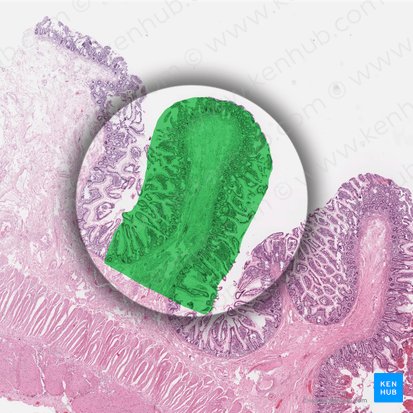 Pliegues circulares (Plicae circulares); Imagen: 