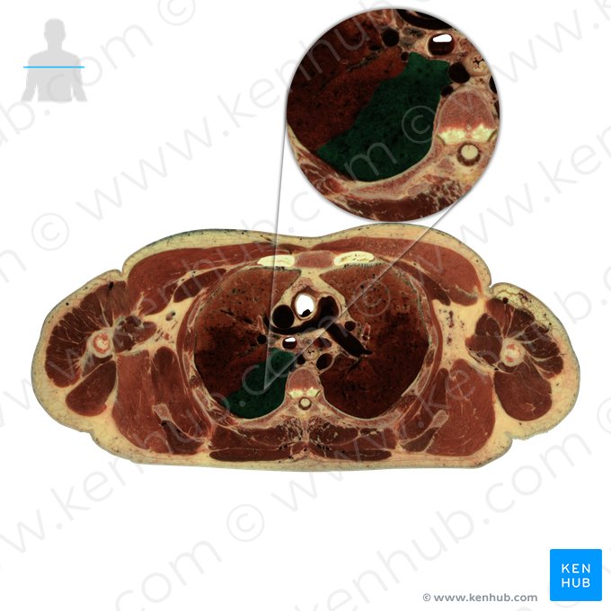 Inferior lobe of right lung (Lobus inferior pulmonis dextri); Image: National Library of Medicine