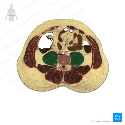 Musculus psoas major (Großer Lendenmuskel); Bild: National Library of Medicine