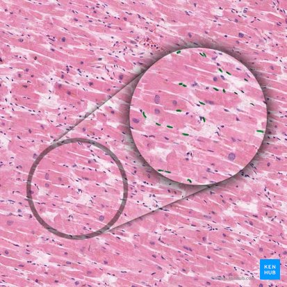 Nucleus fibroblasti (Fibroblastenzellkern); Bild: 