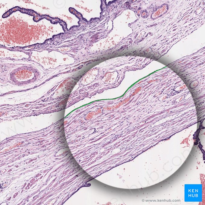 Mesothelium (Mesothel); Bild: 
