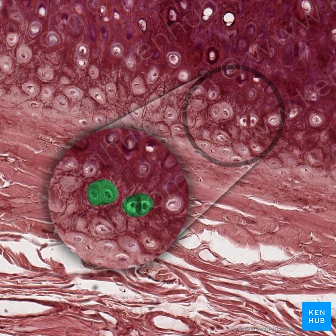 Isogenous group of chondrocytes (Aggregatio isogenica chondrocyti); Image: 