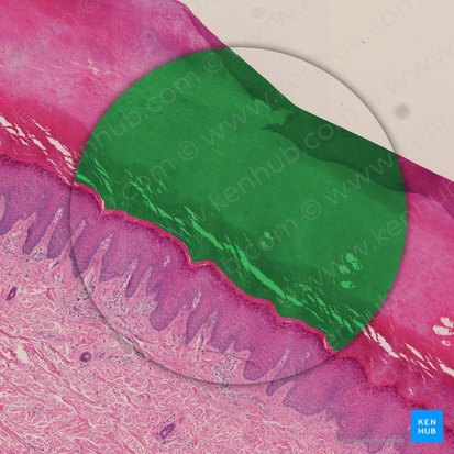 Stratum corneum of epidermis (Stratum corneum epidermis); Image: 