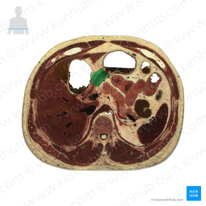 Piloro (Pylorus); Imagem: National Library of Medicine