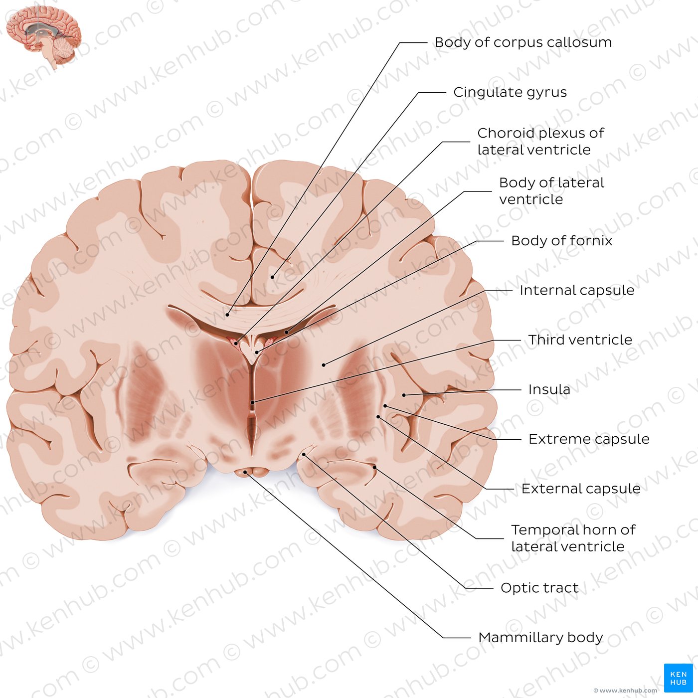 Coronal section of the brain (thalamus level): White matter structures