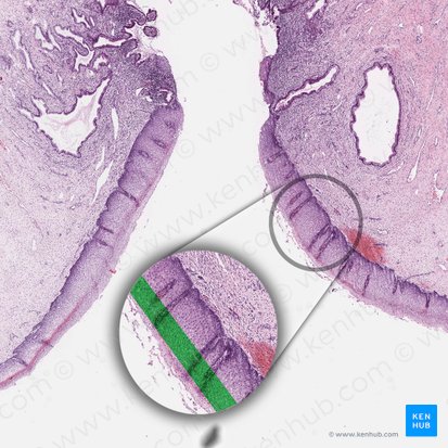 Intermediate cell layer of squamous epithelium; Image: 