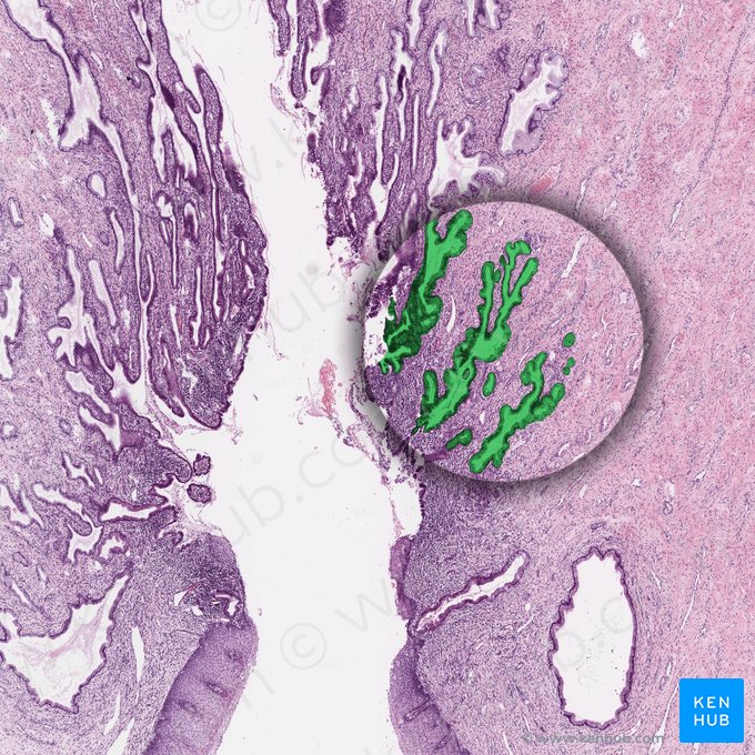 Glándulas cervicales; Imagen: 