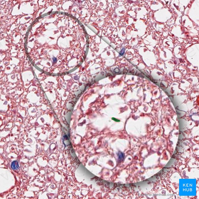 Microgliocytus (Mikrogliazelle); Bild: 