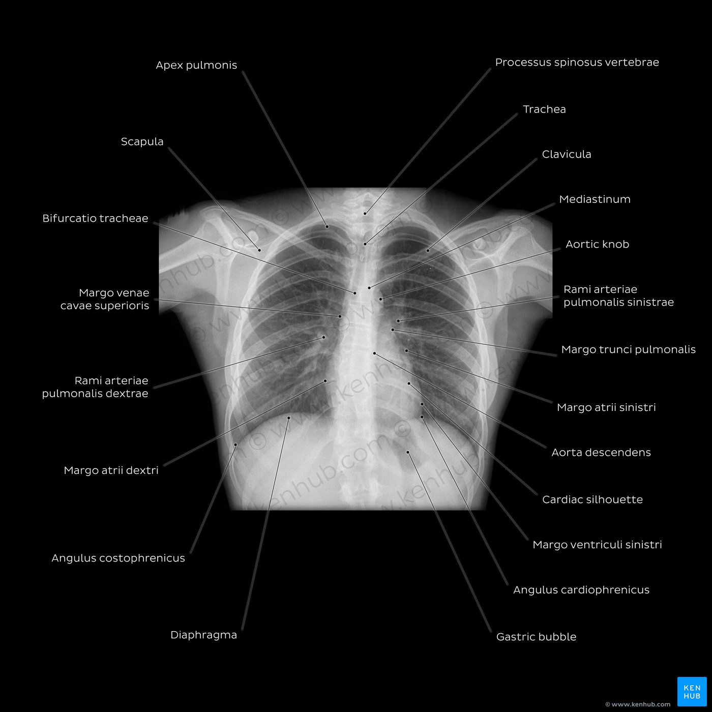 Schritt für Schritt zur Röntgen-Thorax-Befundung | Kenhub