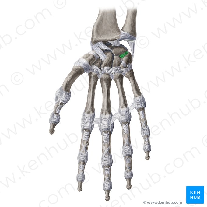 Ligamentum lunotriquetrum palmare (Hohlhandseitiges Mondbein-Dreiecksbein-Band); Bild: Yousun Koh