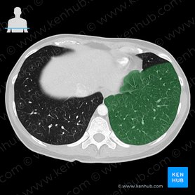 Lobus inferior pulmonis sinistri (Unterlappen der linken Lunge); Bild: 