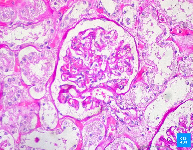 Periodic Acid Schiff stain (Glomerulus) - histological slide