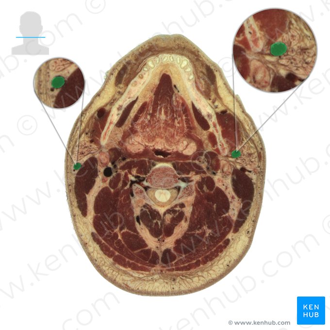 Vena jugularis externa (Äußere Drosselvene); Bild: National Library of Medicine