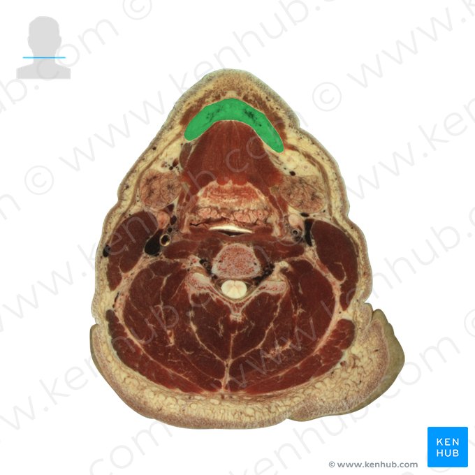 Mandibula (Unterkiefer); Bild: National Library of Medicine