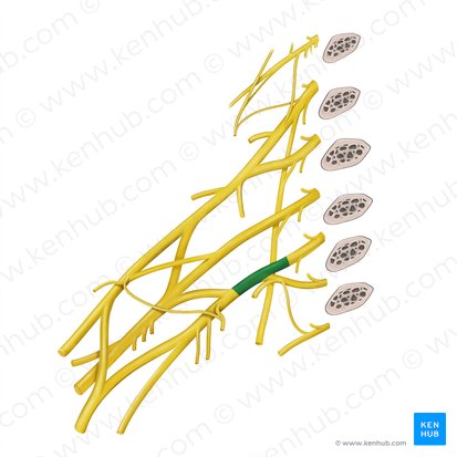 Truncus inferior plexus brachialis (Unterer Stamm des Armgeflechts); Bild: Begoña Rodriguez