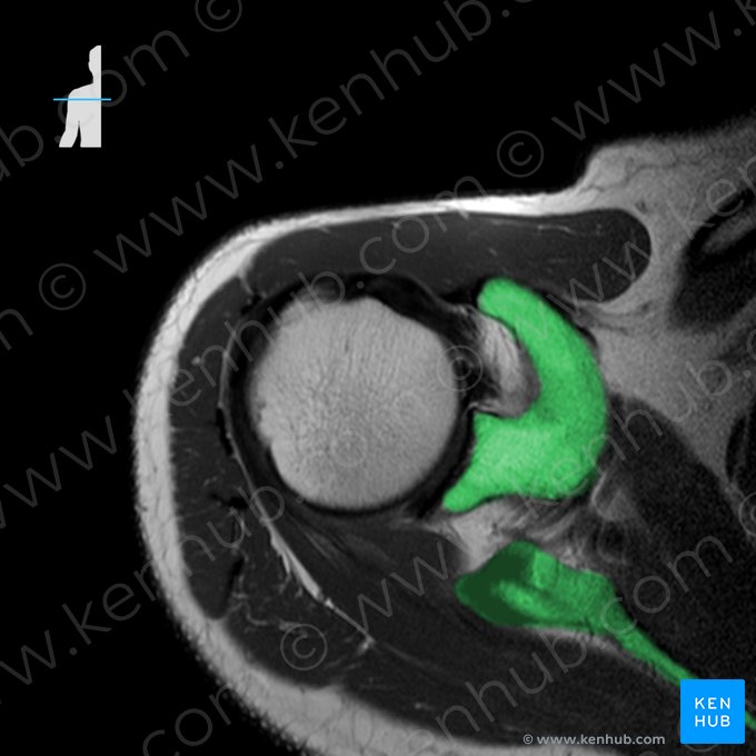 Scapula (Schulterblatt); Bild: 