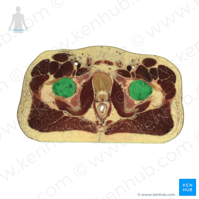 Head of femur (Caput ossis femoris); Image: National Library of Medicine