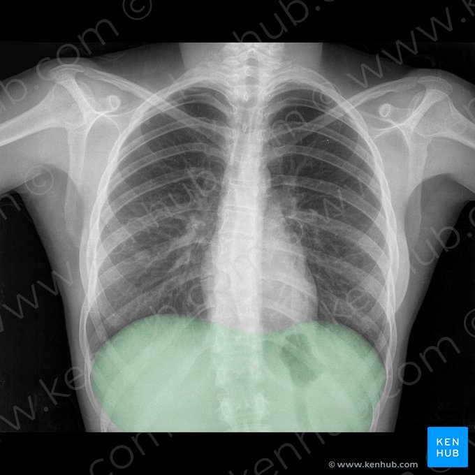 Diaphragm (Diaphragma); Image: 