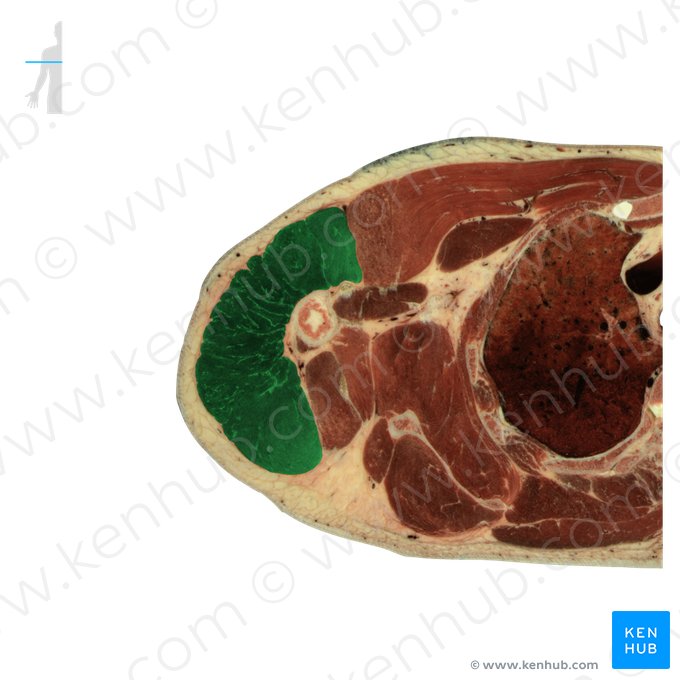 Músculo deltoide (Musculus deltoideus); Imagem: National Library of Medicine