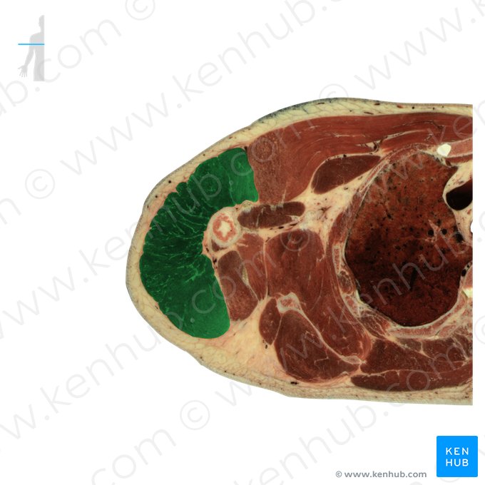 Deltoid muscle (Musculus deltoideus); Image: National Library of Medicine