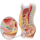 Urogenital diaphragm