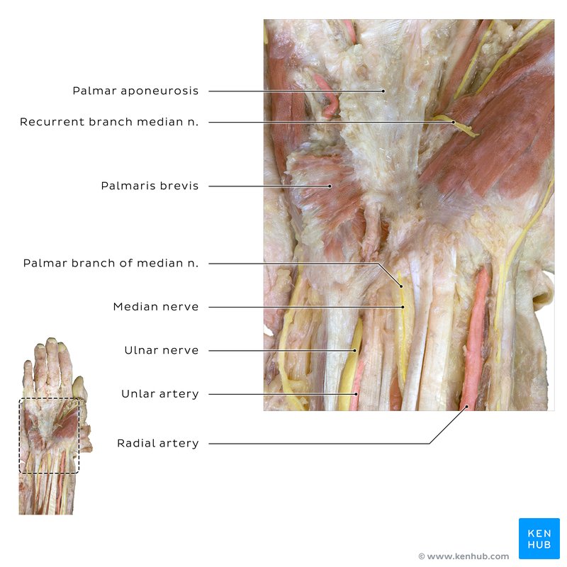 Median nerve in carpal tunnel shown in cadaver