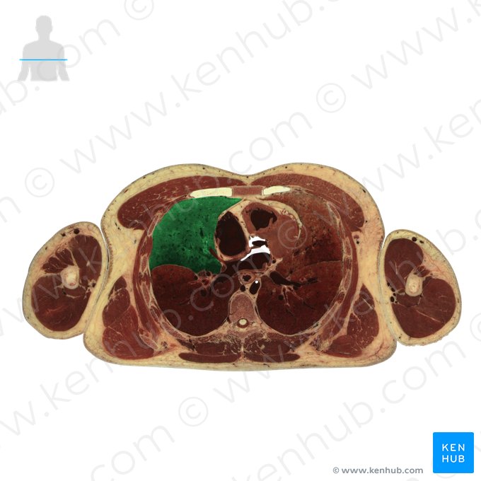 Middle lobe of right lung (Lobus medius pulmonis dextri); Image: National Library of Medicine