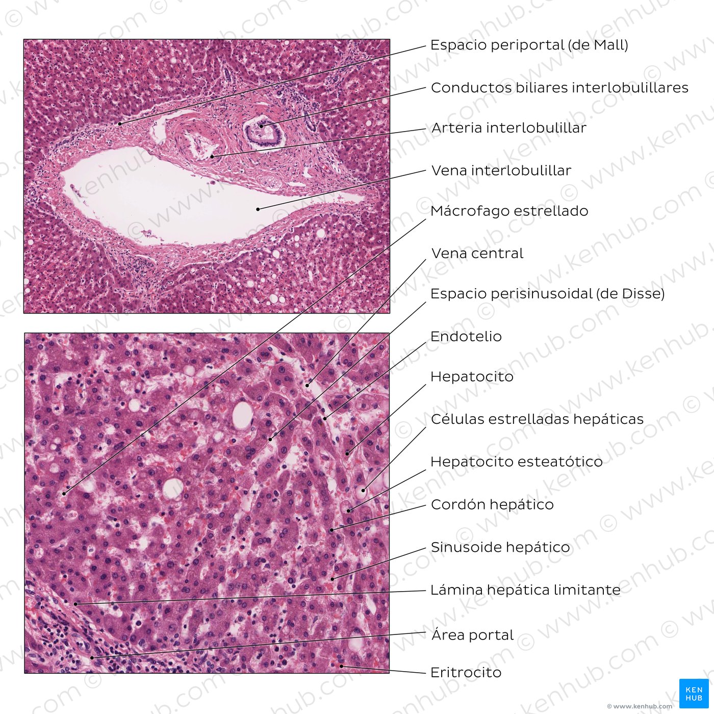 Liver (high magnification)